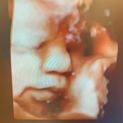 Gynekologická ambulancia MUDr. Petra Turňová (FemRay)